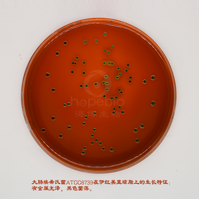 首页 > 微生物图片 >大肠菌群,粪大肠菌群,大肠杆菌 > 大肠埃希氏菌