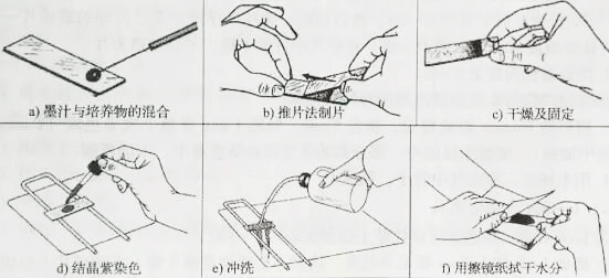 革兰氏染色四个步骤图片