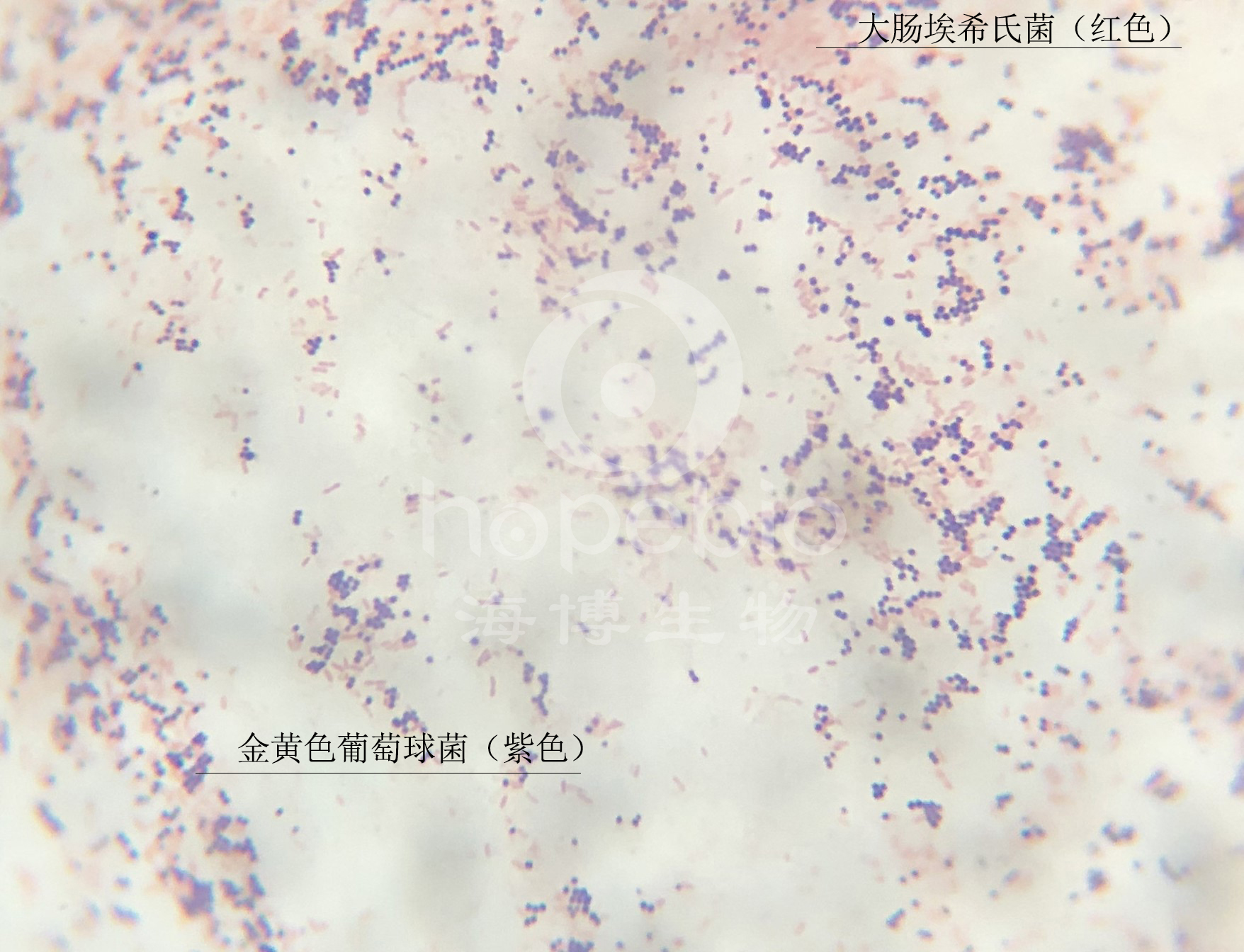 都21世纪了，你还在以雌雄辨别性别吗？|微生物|革兰氏|细菌_新浪新闻