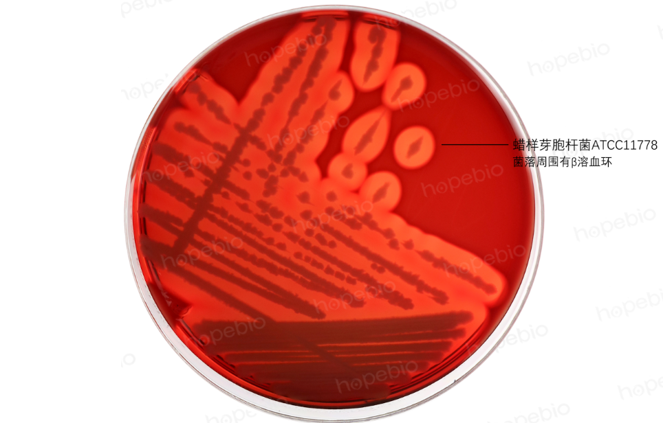 屎肠球菌血平板图片